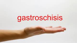 How to Pronounce gastroschisis  American English [upl. by Donelle]