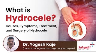 What is Hydrocele  Causes Symptoms Treatment and Surgery of Hydrocele  Dr Yogesh Kaje [upl. by Ephram804]