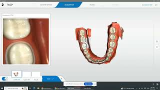 Primescan Scanning Techniques [upl. by Assili]