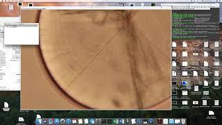 Otolith Increment Analysis ImageJ [upl. by Eoz]