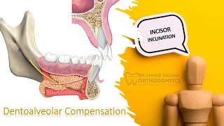 ep20  incisor inclination and dentoalveolar compensation   Diagnostic tips part 2 [upl. by Champaigne]