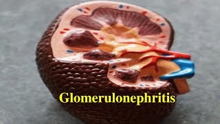 Glomerulonephritis in Hindi [upl. by Howard]