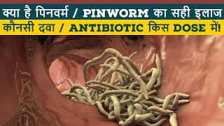 Chunna katne ka ilaj II Pinworm treatment lI Pinworm ki dawa II Chunne ka ilaj II ThyDoc [upl. by Layod]