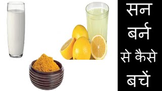 Home Remedies For Sunburn Skin [upl. by Otrebmuh74]