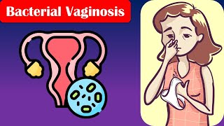 Bacterial Vaginosis  Causes Risk Factors Signs amp Symptoms Diagnosis And Treatment [upl. by Sorodoeht]