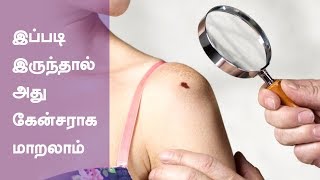 Common Cancer Symptoms and Signs  Health Tips in Tamil [upl. by Ursulette]