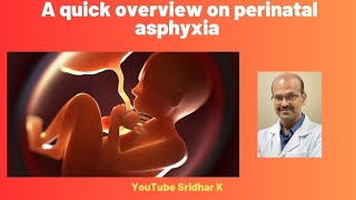 Perinatal asphyxia A quick overview asphyxia perinatalasphyxia birthasphyxia [upl. by Rochemont475]