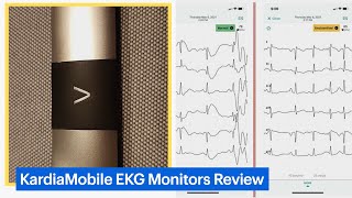 KardiaMobile Personal EKG Monitors Review [upl. by Oiraved]