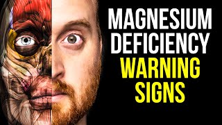 10 Signs of Magnesium Deficiency to Never Ignore [upl. by Nodnarbal]