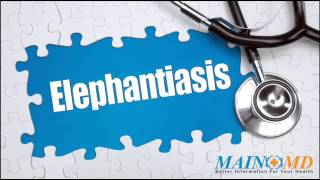 Elephantiasis ¦ Treatment and Symptoms [upl. by Letnuahc]