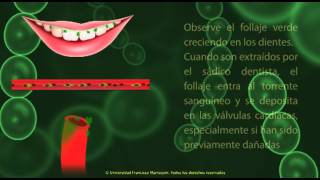 Estreptococcus Grupo Viridans [upl. by Hackney327]