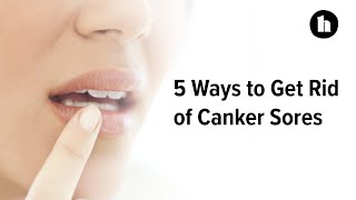 5 Ways to Get Rid of Canker Sores  Healthline [upl. by Aneetsirhc]