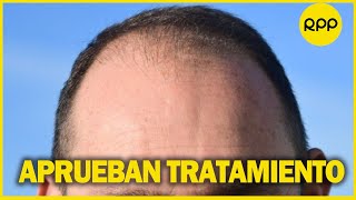 ALOPECIA EEUU aprueba el primer medicamento contra la enfermedad que provoca caída de cabello [upl. by Ayel]