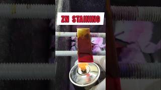 ZN Staining or Ziehl Neelsen staining shorts staining [upl. by Bishop89]