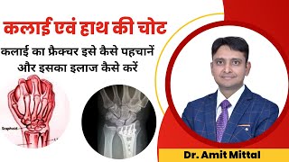 कलाई की हड्डी टूटना  Wrist Fracture  Scaphoid Fracture  Wrist Fracture Exercise in Hindi [upl. by Anuhsal]