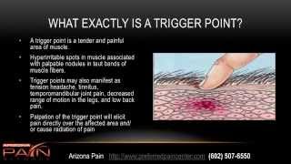 Benefits of Trigger point injections [upl. by Nananne579]