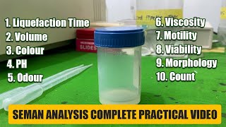 Semen Analysis Test Lab  Complete Practical Video  Medilablife [upl. by Deland417]