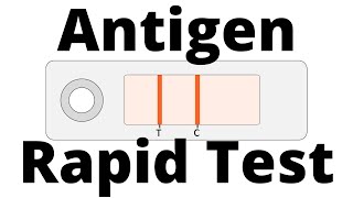 How SARSCoV2 Antigen Rapid Tests work Covid19 Testing [upl. by Hartmann]