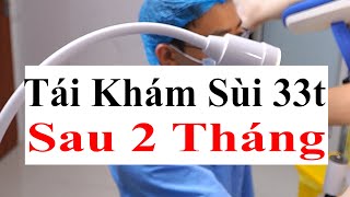 Tái Khám Cho Bệnh Nhân 33t Mắc Sùi Mào Gà Đã Đốt 1 Lần Bằng Dao Điện Tại Bs Sắc [upl. by Papotto]