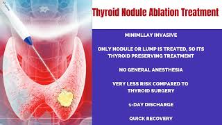 Treating Thyroid Nodule without surgery in Hyderabad  Non Surgical Treatment of Thyroid Lump [upl. by Hacker]