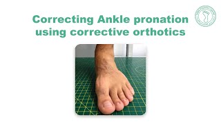 Correcting Ankle pronation using corrective orthotics [upl. by Mufi453]