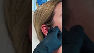 CONCH PIERCING [upl. by Retlaw369]