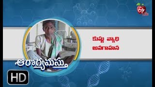 World Leprosy Day  Aarogyamastu  25th January 2019  ఆరోగ్యమస్తు [upl. by Aisac]