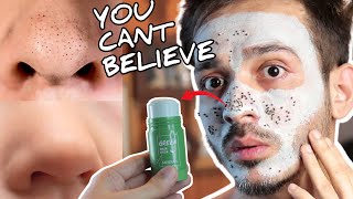 I try VIRAL GREEN MASK STICK amp THIS HAPPENED 😲 Honest Review In Hindi [upl. by Yr]