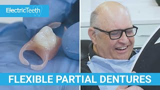 Flexible dentures amp false teeth explained [upl. by Attela]