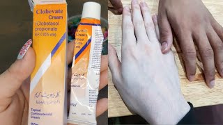 Clobevate cream for whiteninghand and foot whitening cream clobevate cream [upl. by Nnel]