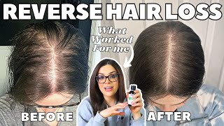 How I STOPPED MY HAIR LOSS  1 Thing That ReGrew My Hair [upl. by Margareta]