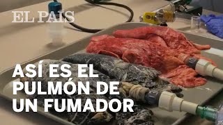 Así se transforma el pulmón de un fumador [upl. by Martreb]