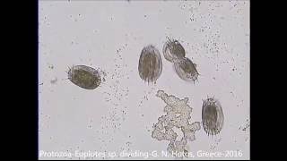 ProtozoaCiliatesEuplotes sp dividingDr G HOTOS Lab GREECE [upl. by Fortunato]