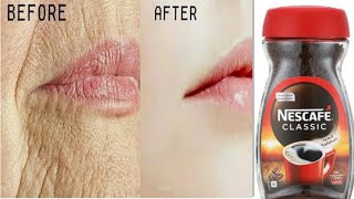 Remove Wrinkles Permanently Overnight NO Botox NO Fillers 100Results II NGworld [upl. by Gilemette]