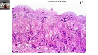 EPITHELIAL TISSUE Practice slides [upl. by Negaem]