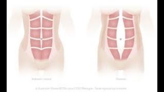 TRAINING ABDOMINAUX [upl. by Portingale]