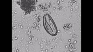 Ovo de Enterobius vermicularis com larva [upl. by Lilla]