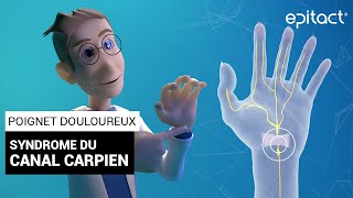 Syndrome du Canal Carpien  Explications – EPITACT [upl. by Airla270]