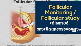 All About Follicular Study Follicular Monitoring Malayalam [upl. by Freemon]