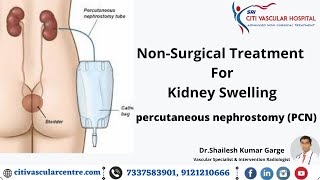 Percutaneous Nephrostomy  PCN  Non Surgical Treatment for Kidney Swelling  Official Video [upl. by Ennaeus]