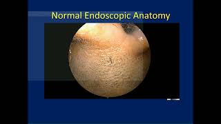 Neurosurgery On the Go Sinonasal Anatomy – Nasal Cavity and Sphenoid Sinus [upl. by Nahguav240]