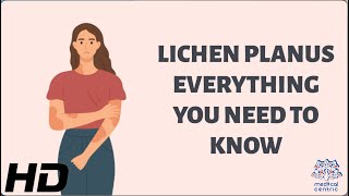 Unlocking the Mystery of Lichen Planus  Everything You Need to Know [upl. by Richards]