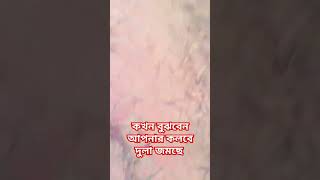 কি ভাবে বুঝবেন আপনার মনে ময়লা জমছে।islamicstatus islamicgojol foryou isalamicshort [upl. by Artened]