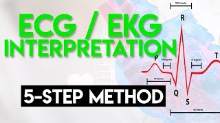 ECG Interpretation Made Easy  ECG EKG Interpretation Part 2 [upl. by Sousa]