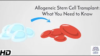 Allogeneic Stem Cell Transplant What You Need to Know [upl. by Alesram123]