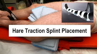 Hare Traction Splint Placement [upl. by Brier468]