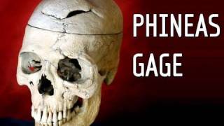 Phineas Gage A Song [upl. by Edyaw]