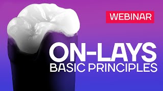 ONLays  basic principles Webinar [upl. by Llerihs301]