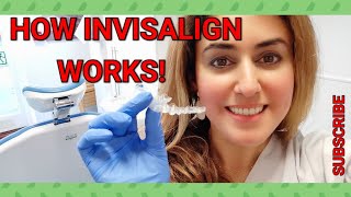 How Invisalign Braces Work Explained By Orthodontist  Best Invisalign Facts [upl. by Airamalegna]