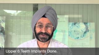 implants teeth for indian army col done at jalandhar punjab india [upl. by Nnairek]